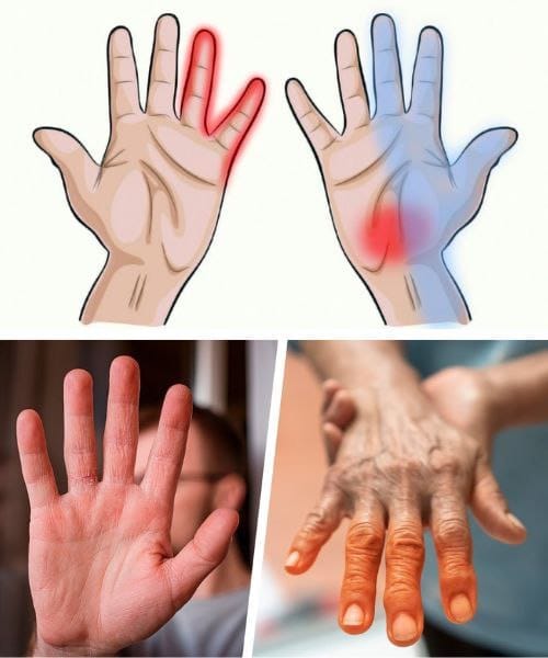 7 Health Insights You Can Learn from Your Hands