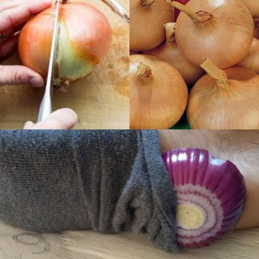 Exploring the Quirky Onion Sock Ritual A Surprising Path to Wellness