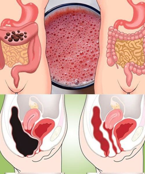 How to Naturally Cleanse Your Colon at Home with a Colon Cleanse Smoothie