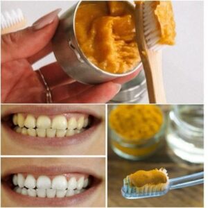 The Oral Health Benefits of Turmeric A Natural Solution for a Healthier Smile